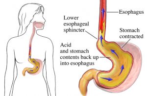 medical-illustration-stomach